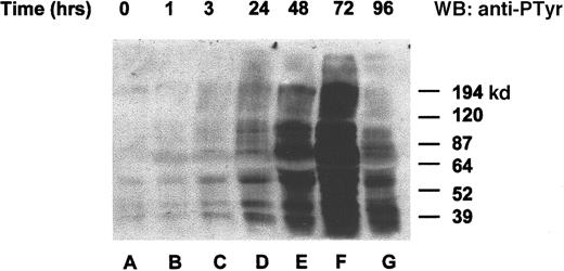 Fig. 2. Orthovanadate increased tyrosine phosphorylation of many proteins. / HCD57 cells were deprived of EPO and treated with 70 μmol/L orthovanadate. Whole cell extracts from 0 (lane A), 1 (lane B), 6 (lane C), 24 (lane D), 48 (lane E), 72 (lane F), and 96 (lane G) were analyzed on a Western blot (WB) probed with an antiphosphotyrosine antibody as described in “Materials and methods.”
