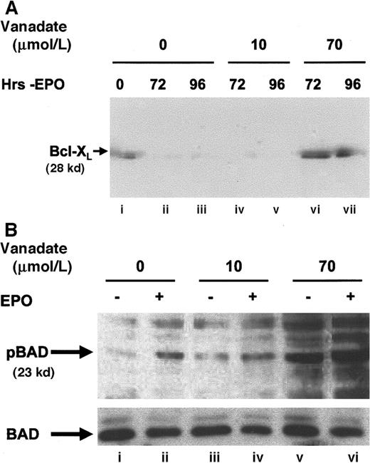 Fig. 3. Orthovanadate maintains Bcl-XL levels and induces BAD phosphorylation. / (A) HCD57 cells were cultured in the presence of EPO (lane i), in the absence of EPO (lanes ii and iii), or in the absence of EPO and supplemented with 10 (lanes iv and v) or 70 μmol/L (lanes vi and vii) orthovanadate for 72 and 96 hours. Cell extracts were then immunoprecipitated with anti–Bcl-XL (Santa Cruz) antibody raised in rabbit. Immunoprecipitates were analyzed by Western blot with anti–Bcl-XL (UBI) antibody raised in mouse. (B) HCD57 cells were deprived of EPO and cultured 24 hours in 0 (lanes i and ii), 10 (lanes iii and iv), or 70 (lanes v and vi) μmol/L orthovanadate. The cells either were stimulated with 10 units EPO/mL (lanes ii, iv, and vi) or mock treated for 5 minutes (lanes i, iii, and v). Whole cell extracts were analyzed by Western blot with anti–anti-phosphoBAD antibody. The blot was stripped and reprobed with anti-BAD antibody.