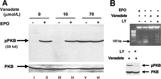 Fig. 7. Orthovanadate activates the PI-3 kinase/PKB/Akt cascade and PI-3 kinase activity is required for survival in orthovanadate-treated HCD57 cells. / (A) HCD57 cells were deprived of EPO and cultured 24 hours in 0 (lanes i and ii), 10 (lanes iii and iv) or 70 μmol/L orthovanadate (lanes v and vi). The cells were either stimulated with 10 units EPO per milliliter (lanes ii, iv, and vi) or mock treated for 5 minutes (lanes i, iii, and v). Whole cell extracts were analyzed by Western blot with anti–phospho-PKB/Akt antibody. The blot was stripped and reprobed with anti-PKB/Akt antibody (lower part of panel) as a loading control. (B) HCD57 cells were deprived of EPO and treated with 50 μmol/L orthovanadate for 24 hours. The 50 μmol/L LY294002 was added to one aliquot of these cells for the 24-hour interval. For each aliquot, 10 μg of genomic DNA was analyzed by agarose gel for fragments of DNA characteristic of apoptosis (upper panel). Whole cell extracts were analyzed by Western blot with anti–phospho-PKB/Akt antibody (lower panel). The blot was stripped and reprobed with anti-PKB/Akt antibody as a loading control (bottom of lower panel).