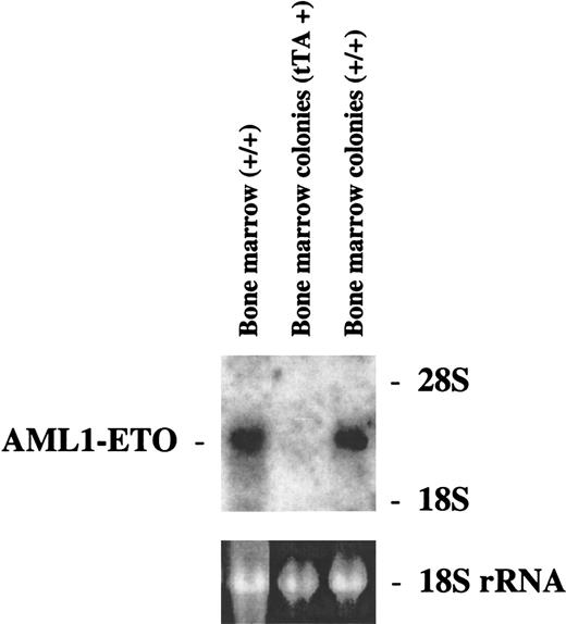 Fig. 6. Northern blot analysis of AML1-ETO expression in the bone marrow or bone marrow colonies of founder line #8. / Transgenic mice that were positive for either MMTV-tTA or for MMTV-tTA and pUHD–AML1-ETO were killed, and bone marrow was harvested from the femurs and tibias of these mice. Some of the bone marrow from these mice was used to perform CFU assays. Total RNA was harvested from the rest of the bone marrow from the double-positive mice as well as from the colonies from the CFU assays. Each RNA sample (10 μg) was electrophoresed. The RNA was then transferred to a nylon membrane and hybridized with a fragment of the ETO cDNA. The ethidium bromide staining of the 18S ribosomal RNA is presented to show the loading of the RNA samples.