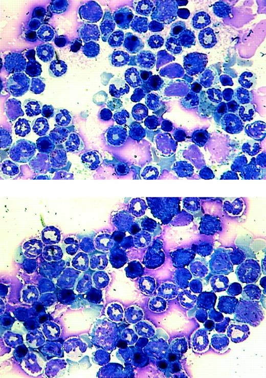 Fig. 7. Morphological analysis of bone marrow cells from the transgenic mice. / Bone marrow samples were prepared from a wild-type littermate (top panel) and an MMTV-tTA and pUHD–AML1-ETO double-positive mouse and stained with Wright-Giemsa solution.