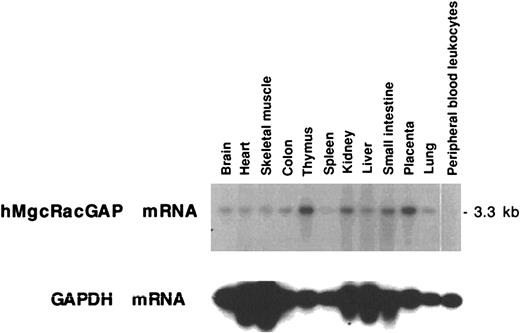 Fig. 3. Tissue distribution of hMgcRacGAP mRNA. / Human multiple-tissue RNA blot (Clontech, Palo Alto, CA) containing poly(A)+ RNA from the indicated tissues was probed with the full-length hMgcRacGAP cDNA probe. A GAPDH cDNA was used as a control probe.