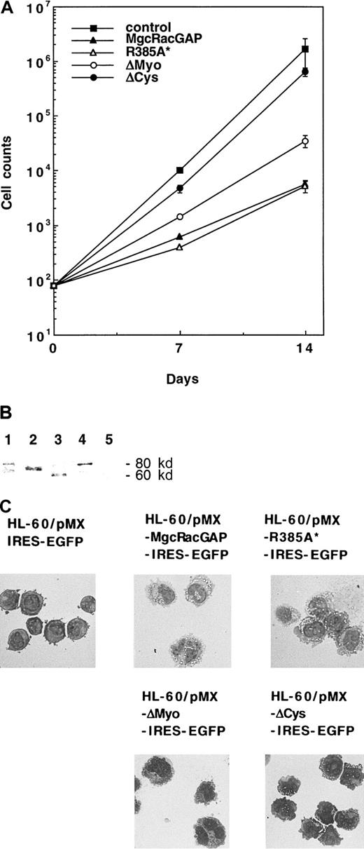 Fig. 9. Functional analysis of the mutants of hMgcRacGAP. / (A) Suppression of growth of HL-60 cells overexpressing the wild-type or mutated hMgcRacGAPs. Each of the wild-type, the mutant R385A*, and 2 deletion mutants was transduced into HL-60 cells using the retrovirus vector pMX-IRES-EGFP. GFP+ HL-60 cells transduced with these viruses were sorted on FACS 2 days after virus infection. GFP+ HL-60 cells, transduced with a blank pMX-IRES-EGFP vector, were sorted as a negative control. The cell number of each transfectant was plotted against time. The results shown are the averages ± SD of triplicate cultures. (B) Expression of the Flag-tagged wild-type and mutant hMgcRacGAPs in HL-60 transfectants. Cell lysates from control HL-60 cells (lane 5) and HL-60 transfectants expressing the wild-type (lane 1), ΔCys (lane 2), ΔMyo (lane 2), or R385A* (lane 4) MgcRacGAP (3 × 107 per lane) were examined by Western blotting using the anti-Flag M2 monoclonal antibody. (C) Differentiation of HL-60 cells overexpressing the wild-type or mutated hMgcRacGAPs. Morphologic differentiation of control HL-60 cells and HL-60 cells transduced with the wild-type, R385A*, or deletion mutants of hMgcRacGAP is shown. Cells were centrifuged onto glass slides and stained with May-Grunwald-Giemsa stain. Photographs were taken at 400 × magnification.