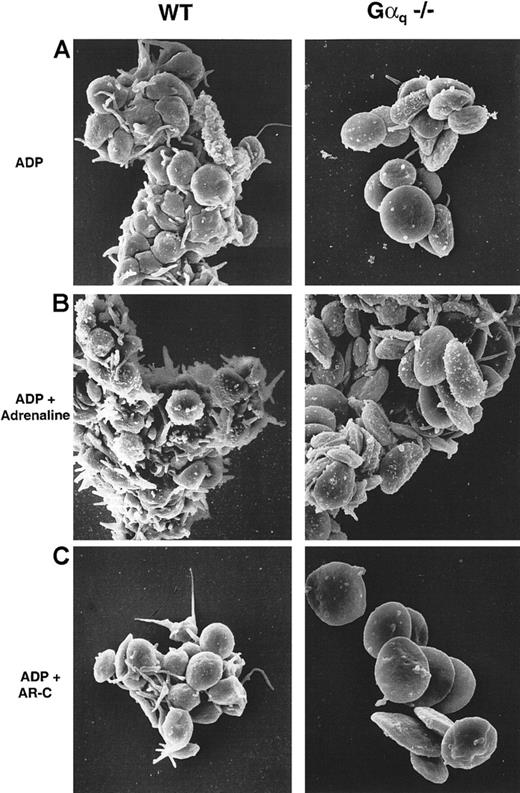 Fig. 4. P2cyc-induced aggregation occurs without shape change in Gαq-deficient platelets. / SEM of WT (left panels) and Gαq-deficient mouse platelets (right panels). (A) 100 μmol/L ADP induced shape change and aggregation in WT platelets, whereas Gαq-deficient platelets did not change shape and formed comparatively smaller aggregates. (B) Addition of adrenaline (10 μmol/L) increased the size of these aggregates without modifying the platelet shape. (C) The P2cyc antagonist AR-C69931MX (10 μmol/L) inhibited aggregation in both WT and Gαq-deficient mouse platelets although not the shape change of WT platelets.