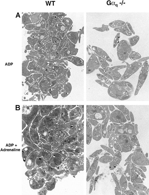 Fig. 5. P2cyc-induced aggregation occurs without degranulation in Gαq-deficient platelets. / TEM of WT (left panels) and Gαq-deficient mouse platelets (right panels) stimulated with 100 μmol/L ADP in the presence (panel B) or absence (panel A) of adrenaline (10 μmol/L). Secretion did not occur in WT or Gαq-deficient platelets, while shape change was blocked only in Gαq-deficient mouse platelets.