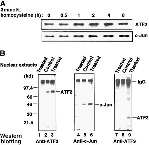 Fig. 7. Increased amount of ATF2, c-Jun, and ATF3 proteins and their association in HUVECs stimulated by homocysteine. / (A) Cultured HUVECs were exposed to 3 mmol/L homocysteine for the indicated time, and their whole-cell extracts (20 μg) were subjected to Western blot with anti-ATF2 or anti–c-Jun antibody as described in “Materials and methods.” (B) Nuclear extracts prepared from the control and homocysteine-stimulated cells for 4 hours were immunoprecipitated with anti-ATF2 antibody as described in “Materials and methods.” The resultant complexes were separated on a 12% SDS-PAGE under nonreducing conditions, under which IgG migrated as a protein of large molecular mass, and analyzed by Western blotting with anti-ATF2 (lanes 1-3), anti–c-Jun (lanes 4-6), or anti-ATF3 (lanes 7-9) antibody as probe. Lanes 1, 4, and 7 were results of the homocysteine-treated nuclear extracts immunoprecipitated with nonimmune IgG.