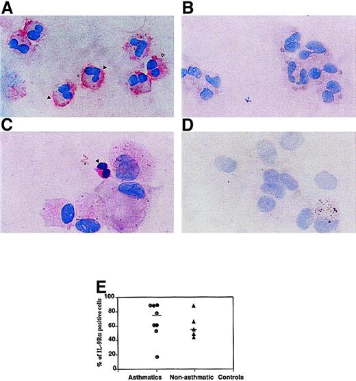 Fig. 3. Detection of IL-9R immunoreactivity on peripheral blood and BAL eosinophils. / (A) Specific staining was detected on the cell membrane (solid arrow) as well as the cytoplasm (open arrow) of purified peripheral blood human eosinophils. (C) Positive staining of BAL eosinophil (solid arrow) from asthmatic individual. Normal rabbit serum was used as the negative controls for the (B) peripheral blood eosinophils and (D) BAL cells. (E) Quantification of IL-9R–α+ cells in asthmatics and nonasthmatic controls. The percentage of IL-9R–α+ peripheral blood eosinophils from asthmatics and nonasthmatic controls was determined by counting 500 cells per slide. There was no significant difference between the 2 groups using immunocytochemical methods to detect the IL-9R–α (P > .05). The staining was performed using the affinity-purified rabbit pAb anti–IL-9R–α (directed to C-terminus specific domain; final dilution, 1 μg/mL) followed by biotin-labeled swine antirabbit Ig and streptavidin phosphatase alkaline. Counterstaining was performed using hematoxylin.