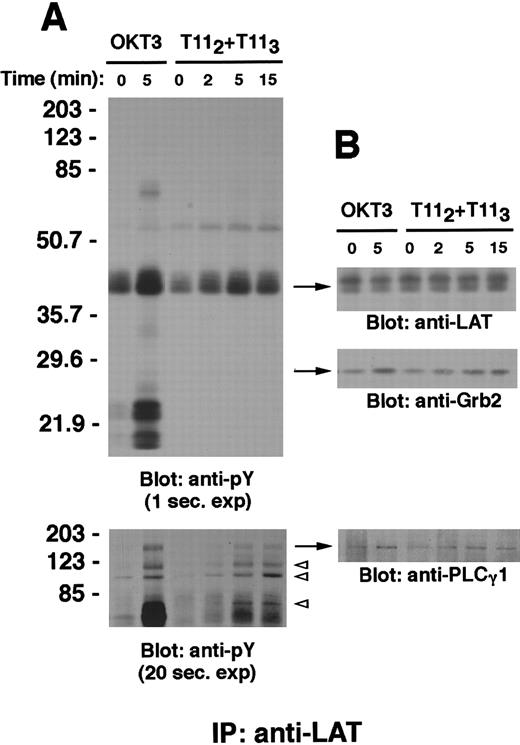 Fig. 2. LAT is tyrosine phosphorylated and associates with PLCγ-1, Grb-2, and other tyrosine phosphorylated proteins on CD2 stimulation. / Wild-type Jurkat T cells (107 cells) were stimulated with either the mitogenic pair of anti-CD2 mAbs T112 and T113 or anti-CD3ε mAb OKT3 at 37°C for the indicated periods of time. PNLs were prepared as described in “Materials and methods,” either subjected to immunoprecipitation with the rabbit polyclonal antibody anti-LAT or incubated with protein A–agarose alone (not shown), separated by SDS-PAGE, and immunoblotted with the antiphosphotyrosine antibody 4G10 (A, upper panel). A longer exposure of the upper part of the same membrane is shown to demonstrate bands corresponding to phosphotyrosine-containing proteins of molecular weight between 70 and 203 kd (A, lower panel); in particular, phosphotyrosyl bands of approximate molecular weight of 120, 97, and 76 kd are indicated by open arrowheads. The membrane was stripped and reblotted with anti-LAT (B, upper panel), anti-Grb-2 (B, middle panel) and anti-PLCγ-1 antibody (B, lower panel). Results are representative of 3 independent experiments.