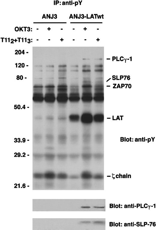 Fig. 5. LAT is required for tyrosine phosphorylation of PLCγ-1 and SLP-76 on CD2 stimulation of Jurkat T cells. / The LAT-deficient Jurkat T-cell line ANJ3 and the ANJ3 reconstituted with wild-type LAT (ANJ3-LATwt) (107 cells/test) were either left unstimulated or stimulated at 37°C for 5 minutes via either the CD2 or TCR-CD3 molecule, as indicated in Figure 1, and lysed in 1% Brij97 lysis buffer. PNLs were immunoprecipitated with 20 μL of antiphosphotyrosine (PY99) mAb-agarose conjugated, separated by SDS-PAGE, and immunoblotted with 4G10 (upper panel). The same membrane was stripped and blotted with anti-PLCγ-1 and anti-SLP-76 antibody (lower panels). The bands corresponding to PLCγ-1, SLP-76, ZAP70, LAT, and zeta-chain proteins are indicated. Results are representative of 2 independent experiments.