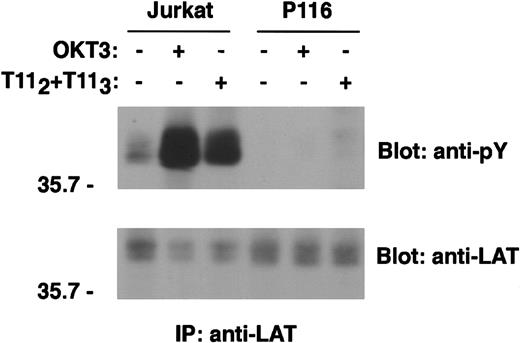 Fig. 6. ZAP70/Syk kinase expression is required for CD2-dependent LAT phosphorylation. / Wild-type Jurkat cells and the ZAP70/Syk-deficient clone P116 (107 cells/test) were left unstimulated or stimulated with either T112+T113 or OKT3 for 5 minutes. PNLs were immunoprecipitated with rabbit anti-LAT antibody or incubated with protein A–agarose alone (data not shown), resolved by SDS-PAGE, and immunoblotted with the antiphosphotyrosine 4G10 mAb. Analysis of LAT tyrosine phosphorylation is shown (upper panel). Immunoprecipitation of comparable amounts of LAT protein was confirmed by stripping the membrane and reblotting with anti-LAT–specific antibody (lower panel). Note that the anti-LAT antibody recognizes the tyrosine phosphorylated form of the protein less efficiently. Results are representative of 4 independent experiments.