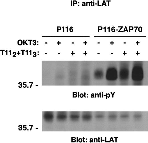 Fig. 7. Reconstitution of the ZAP70/Syk-deficient P116 cell line with wild-type ZAP70 restored CD2-mediated induction of LAT phosphorylation. / ZAP70/Syk-deficient Jurkat cells (P116) and the ZAP70-reconstituted clone (P116-ZAP70) were either left unstimulated or stimulated via either CD2 or TCR-CD3 or both receptors for 5 minutes, as described in “Materials and methods.” Immunoprecipitation of LAT was then performed as in Figure 6. Tyrosine phosphorylation of LAT is shown (upper panel). The same membrane was stripped and reblotted with anti-LAT–specific antibody (lower panel). Results are representative of 2 independent experiments.