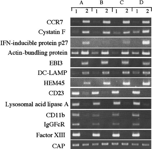 Fig. 3. RT-PCR analysis of genes expressed differently in IMDCs and MADCs. / RT-PCR was performed on total RNA isolated from (1) IMDCs and (2) MADCs, as described in “Materials and methods.” A, B, C, and D indicate different donors.