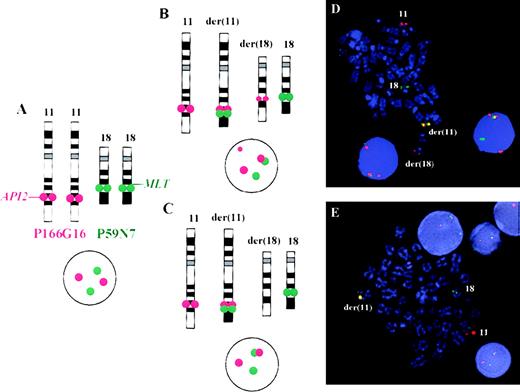 Fig. 3. Fluorescence in situ hybridization assay for the detection of t(11;18)(q21;q21) on metaphase chromosomes and interphase nuclei. / (A) On the left side, the normal localization of PACs 166G16 and 59N7 can be seen. As shown in panels B and C, t(11;18) leads to a fusion or colocalization signal of both probes on the derivative chromosome 11. (D) PAC 166G16 is split by the translocation leading to either 3 hybridization signals of this probe located on the derivative chromosomes 11 and 18 and the normal chromosome 11 (case 8) or, (E) in the case of a deletion of chromosome 11 sequences, to 2 signals of this probe located on the derivative chromosome 11 and the normal chromosome 11 (case 6).