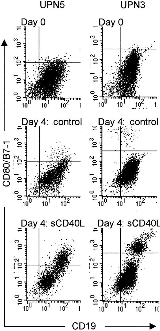 Fig. 2. Induced expression of CD80/B7-1 after huCD40LT stimulation of primary MCL cell cultures. / Isolated mononuclear cells from 6 MCL patients were thawed at day 0 and analyzed using flow cytometry, or seeded at 2 × 106cells/mL and cultured in the presence or absence of 400 ng/mL for 4 days. Before and after culture, the harvested cells were incubated with anti-CD19 (FITC) and anti-CD80/B7-1 (PE) antibodies. A total of 5000 cells were counted using standard flow cytometry analysis. The 2 MCL patients shown represent one case with low (no. 5) and one with high (no. 3) proliferative response to huCD40LT stimulation, respectively. Dot-plot analyses are shown from day 0 and after 4 days of culture, in the absence (day 4: control) or presence of huCD40LT (day 4: huCD40LT) from the 2 MCL patients. sCD40L indicates huCD40LT stimulation.