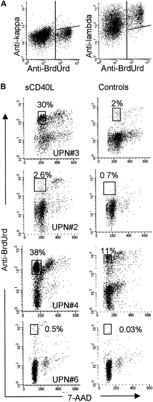 Fig. 3. Induction of cell-cycle progression and proliferation of clonal cells after huCD40LT stimulation of primary MCL cell cultures. / Isolated mononuclear cells from 4 MCL patients were seeded at 2 × 106 cells/mL and cultured in the presence or absence of 400 ng/mL for 4 days. On day 4, the cultures were incubated with bromodeoxyuridine (BrdUrd) for 24 hours. After harvest, the cells were analyzed using multiparameter flow cytometry. (A) Dot-plot analyses of kappa and lambda light-chain expression, respectively, combined with detection of BrdUrd incorporation in one MCL cell culture after stimulation with huCD40LT. (B) Dot-plot analyses of simultaneous detection of BrdUrd incorporation (DNA synthesis) and 7-amino-actinomycin-D (7-AAD) (DNA content) after exclusion of small DNA fragments and of cells that did not clearly express the light chain of the malignant clone of the particular MCL case. Dot-plot analyses of 4 huCD40LT-stimulated and -unstimulated MCL cell cultures are shown (displayed dots represent 25% of total counts). The percentages of cells in the framed regions indicate the fraction of cells that traversed through S-phase with BrdUrd incorporation, completed cell division, and returned to G1-phase. sCD40L indicates huCD40LT stimulation.