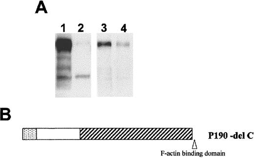 Fig. 1. Expression of the Bcr/Abl p190 del C mutant. / (A) Western blot analysis of expression of p190 Bcr/Abl proteins in COS cells. Lanes 1 and 2 were reacted with antiserum directed against the C-terminal end of Abl (Oncogene Science, Inc, c-Abl Ab-2), whereas lanes 3 and 4 were incubated with antibodies directed against more upstream sequences of Abl (Oncogene Science, Inc, c-Abl Ab-3). COS-1 cells were transfected with p190 wild type (lanes 1,3) or p190 del C (lanes 2,4). (B) Schematic representation of the Bcr/Abl p190 del C mutant protein. The dotted region represents the N-terminal oligomerization domain of Bcr; the open box, other sequences encoded by Bcr exon 1. The hatched area represents the Abl protein moiety.
