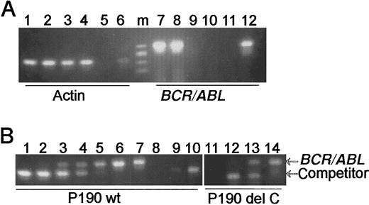 Fig. 2. Quantitative competitive PCR analysis of p190 wild-type and p190 del C expression. / (A) RT-PCR analysis of wild-type p190 expression. Primers are as indicated beneath the lanes. Lanes 1, 3, 7, and 9, p190 wild-type no. 1; lanes 2, 4, 8, and 10, p190 wild-type no. 2. Lanes 1, 2, 7, and 8, bone marrow; lanes 3, 4, 9, and 10, peripheral blood. Lanes 5 and 11, negative control (no RNA added); lanes 6 and 12, positive control no. 2207 RNA. m = φX/HaeIII marker. (B) Quantitative competitive PCR analysis of p190 wild-type and del C expression. Arrows point to the location of the transgenic BCR/ABL 305-bp and the 260-bp competitor fragments. The reactions shown in lanes 1 to 6 (p190 wild-type no. 1) and lanes 12 to 14 (p190 del C animal no. 4445; no. 4208 line) each contained 2 μg of total bone marrow RNA and varying amounts of competitor: 0.5 × 107 molecules, lane 1; 0.5 × 106, lane 2; 0.5 × 105, lanes 3 and 12; 0.5 × 104, lanes 4 and 13; 0.5 × 103, lanes 5 and 14; no competitor, lane 6; positive control RNA no. 2207, lane 7; no RNA, lanes 8 and 11; and 104 and 105 molecules competitor only, lanes 9 and 10, respectively.