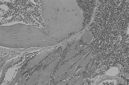 Fig. 5. Involved bone marrow of mouse no. 5085 (p190 del C no. 4243 line). / Magnification × 20. Tissues were stained with hematoxylin-eosin stain.