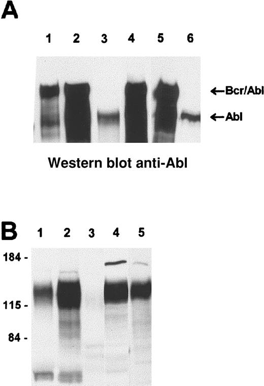 Fig. 6. Western blot analysis of involved tissues from. / BCR/ABL p190 transgenics. Lysates from different tissues were run on SDS-PAA (polyacrylamide) gels and Western blotted. (A) Reaction with anti-Abl monoclonal antibodies, which detect both c-Abl and Bcr/Abl. (B) A far-Western blot reacted with the Crkl SH2 domain. Samples include, in panel A, lane 1, bone marrow of no. 5160 (no. 4208 line); lane 2, involved pooled lymph nodes of no. 5160; lane 3, control bone marrow; lane 4, positive control (lymphoma of nonmutated Bcr/Abl p190 transgenic); lane 5, bone marrow of no. 5224 (no. 4208 line); and lane 6, bone marrow of no. 4637 (a mouse of the p190 del C no. 4208 line that died because of liver hyperplasia at 18 months of age). The locations of endogenous Abl and Bcr/Abl are as indicated. Panel B, lane 1, exudate of no. 5085 (p190 del C 4243 line; Figure 5 also); lane 2, no. 5085 pooled lymph nodes; lane 3, lymphoma of a non-BCR/ABL transgenic; lane 4, lymphoma of no. 4909 (no. 4208 line); and lane 5, positive control lymphoma of a transgenic for nonmutated p190 BCR/ABL. The approximate location of molecular weight markers is shown on the left.