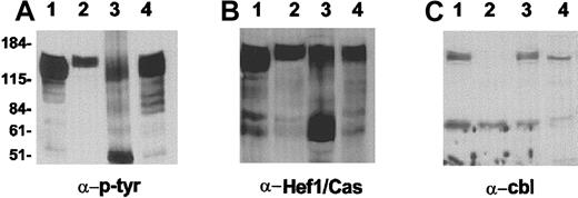 Fig. 7. Analysis of Crkl SH2-binding proteins. / Western extracts were diluted and incubated with GST-Crkl SH2. Binding proteins were resolved on SDS-PAA gels, Western blotted, and reacted with the antibodies indicated below each panel. Lysates included those of lymphomas of animal nos. 4909 and 4690 (Bcr/Abl p190 del C no. 4208 line), lanes 1 and 2; involved pooled lymph nodes of animal no. 5085 (Bcr/Abl p190 del C 4243 line), lanes 3; and control nonmutated p190 Bcr/Abl, lane 4. The approximate locations of molecular weight markers are indicated on the left.