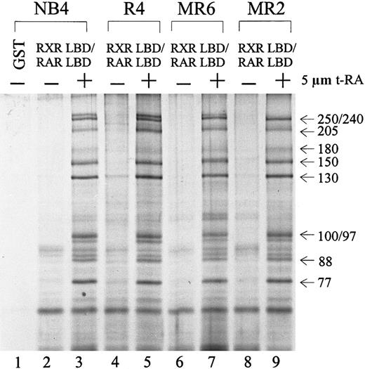 Fig. 3. Ligand-inducible interaction of the DRIP/TRAP complex to RXR/RAR heterodimer in NB4 and 3 RA-resistant NB4 subclones. / Nuclear extracts (1.2 mg) prepared from different cell lines were incubated with 10 to 20 μg of the immobilized GST-RXR LBD/RAR LBD in the absence (−) or presence (+) of 5 μmol/L t-RA. GST alone was used as a negative control (lane 1). The approximate molecular weights of the interacting proteins are indicated at right.