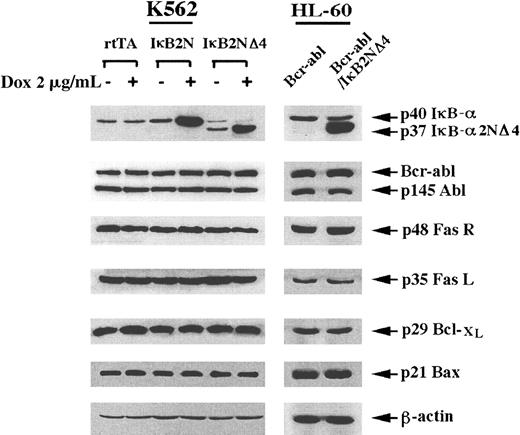 Fig. 3. Immunoblot analyses. / Western analyses of IκBα, IκBα2N, IκBα2NΔ4, Bcr-Abl, Abl, FasR, FasL, Bcl-xL, Bax, and β-actin in K562 and HL-60/Bcr-Abl cells containing doxycycline-inducible and stable expression of transdominant (TD) repressor of IκBα, respectively.