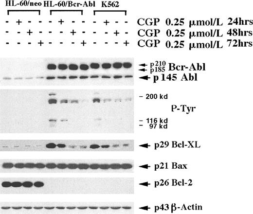 Fig. 4. CGP57148B (CGP) inhibits tyrosine phosphorylation of proteins and down-regulates Bcl-xL in HL-60/Bcr-Abl and K562 cells. / Cells were treated with 0.25 μmol/L CGP for 24 to 72 hours, cellular proteins were extracted and Western analyses of Bcr-Abl, Abl, Bcl-xL, Bax, β-actin, as well as tyrosine phosphorylated proteins (P-Tyr) were performed (see text). Expression levels are representative of 3 separate experiments.
