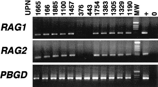 Fig. 3. RAG1 and RAG2 expression in BCP-ALL. / The 39 BCP-ALLs included 9 MLL-AF4, 11 E2A-PBX1(1 sIg+ and 10 cIgμ+), 7 BCR-ABL(5 cIgμ+), 1 cIgμ+ TEL-AML, 3 sIg+ (not from the present series), 10 cIgμ+, and 6 cIgμ−, FT-negative cases, including 6 infant ALLs. TCRG rearrangement was seen in 12 of 39 cases.