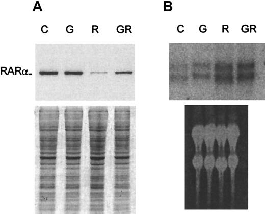 Fig. 4. Analyses of RARα expression in D+ cells treated for 24 hours with ATRA, G-CSF, or their combination. / (A) Western blot. Loading was standardized by equal cell numbers. Coomassie staining of a duplicate gel shows approximately equal amounts of protein in each lane. (B) Northern blot. Ethidium bromide staining of the gel shows approximately equal loading. C indicates untreated control; G, G-CSF (10 ng/mL); R, ATRA (3 μmol/L); GR, combination of G-CSF and ATRA.