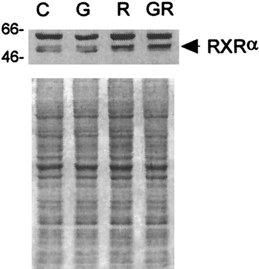 Fig. 5. Western blot analyses of RXRα in D+ cells after incubation with G-CSF, ATRA, or G-CSF + ATRA. / Loading was standardized by equal cell numbers. Coomassie staining of a duplicate gel shows approximately equal amounts of protein in each lane. C indicates untreated control; G, G-CSF (10 ng/mL); R, ATRA (3 μmol/L); GR, G-CSF + ATRA treatment.