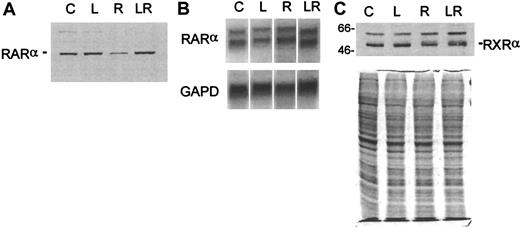 Fig. 7. Analysis of retinoid receptor expression in D+ cells treated for 24 hours with LiCl, ATRA, or their combination. / (A) Western blot analysis of RARα. (B) Northern blot analysis of RARα. The blot was probed for GAPD to show approximately equal loading of RNA. (C) Western blot analysis of RXRα. The blot in A was stripped and reprobed with an antibody to RXRα. Loading was standardized by equal cell numbers. Coomassie staining of a duplicate gel shows approximately equal amounts of protein in each lane. C indicates untreated control; L, LiCl (2.5 mmol/L); R, ATRA (3 μmol/L); LR, combination of LiCl and ATRA.