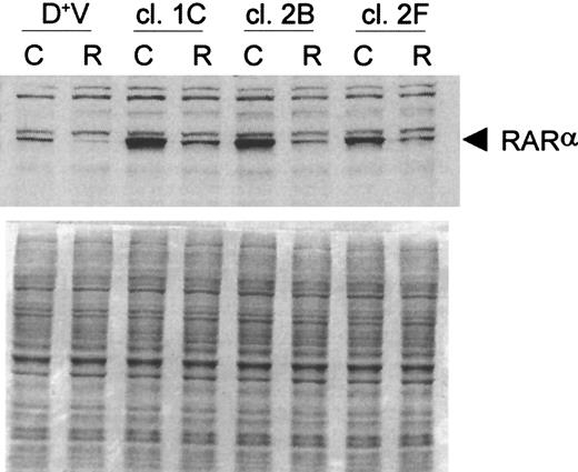Fig. 9. Western blot analysis of RARα in selected RARα-transfected D+ cell clones after 24-hours incubation with 3 μmol/L ATRA. / Loading was standardized by equal cell numbers. Coomassie staining of a duplicate gel shows approximately equal amounts of protein in each lane. D+V indicates vector-transfected D+ cells; C, untreated control; R, ATRA (3 μmol/L).