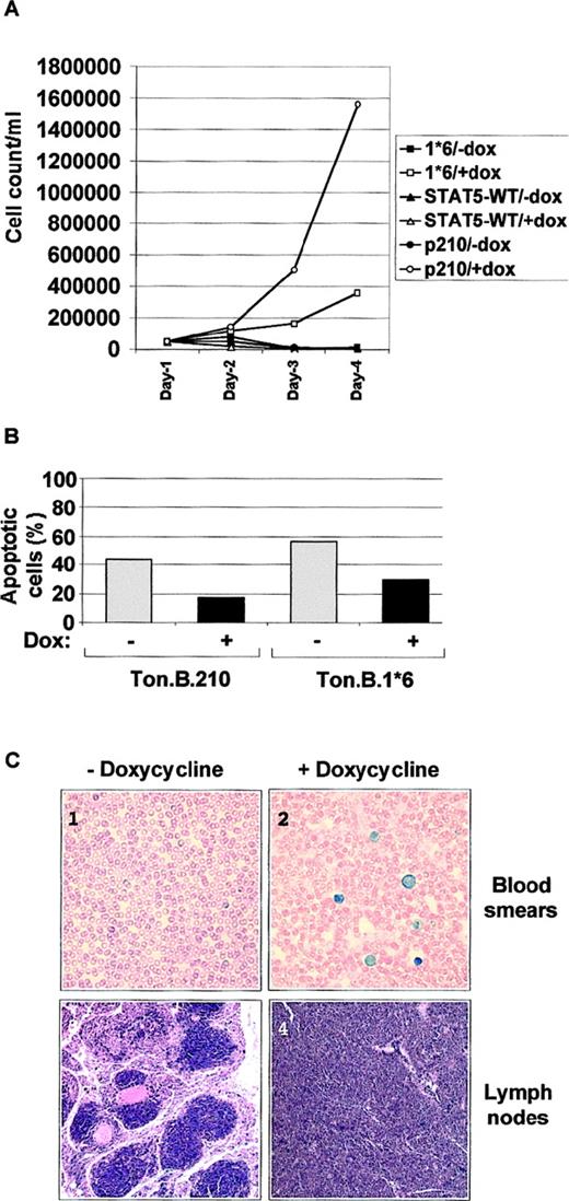 Fig. 2. Constitutive activation of STAT5 mediates growth factor independence and increased in vitro and in vivo. / (A) 5 × 105 Ba/F3 tet-on cells, inducibly expressing either p210Bcr/Abl or wild-type STAT5 (STAT5-WT) or the constitutive active mutant STAT5-1*6 were cultured in RPMI 1640 + 10% FCS with or without doxycycline, as indicated. The number of cells was counted by trypan blue exclusion at the indicated time points. (B) Ton.B.210 and Ton.B.1*6 cells were cultured for 30 hours in RPMI 1640 + 10% FCS with or without doxycycline. 1 × 106 cells were harvested and used for an annexin-V–PI staining procedure, and analyzed as described in “Material and methods.” Results are represented as the percentage of apoptotic cells. (C) 5 × 106 Ton.B.STAT5 or Ton.B.1*6 cells were intraveneously injected into nude mice. For each cell line, the mice were split into 2 groups (5 mice in each group), receiving regular water or water supplemented with 500 μg/mL doxycycline. Mice were killed after 6 weeks, blood smears were prepared and stained with Wright-Giemsa stain, and spleen and lymph nodes were sectioned and smears stained with hematoxylin and eosin. Here are shown blood smears and a lymph node section from Ton.B.1*6 injected mice, treated (pictures 2 and 4) or not (pictures 1 and 3) with doxycycline. Magnification: 60 ×.