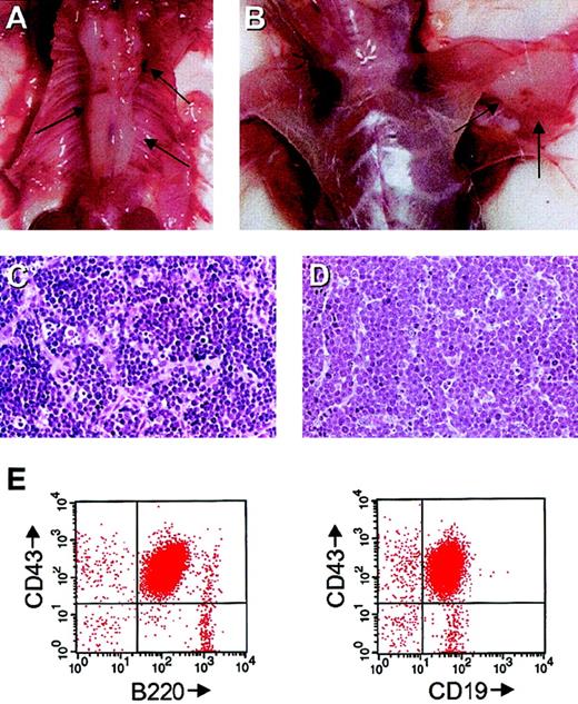 Fig. 3. Ab-MuLV induces pro-B-cell tumors in vivo. / (A,B) Stat5-deficient mice with Ab-MuLV–induced tumors embedding the spine and in the axilla. Arrows indicate the tumors. (C) Hematoxylin-eosin stain of a section of a Stat5 heterozygous tumor. (D) Hematoxylin-eosin stain of a section of a Stat5-deficient tumor. (E) FACS analysis of a Stat5-deficient tumor displaying typical pro-B-cell markers.