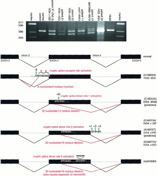 Fig. 2. RT-PCR analysis of mutations affecting splicing and transcript structure. / Each aberrant splicing product appearing on the agarose gel was isolated and sequenced to confirm the interpretation shown in the schematic. The genomic DNA mutations are depicted in green, the resulting cDNA aberration in red. Because no bone marrow was available from patients with the IVS4 + 3SD and IVS4-40SD mutations, the result shown is the predicted result. Note that patient 11 has a 5T insertion and patient 12 a 24-bp deletion, neither of which would be expected to alter splicing. Nevertheless, the 5T insertion produces at least 2 transcripts, one containing the 5T insertion and another unanticipatedly forcing utilization of the 2nd cryptic upstream splice donor site. For patient 12, whereas only 2 transcripts were identified (the normal and one containing the 24-bp deletion) following subcloning and sequencing, uncharacterized higher molecular weight products that presumably represent misprocessed primary transcripts are apparent.