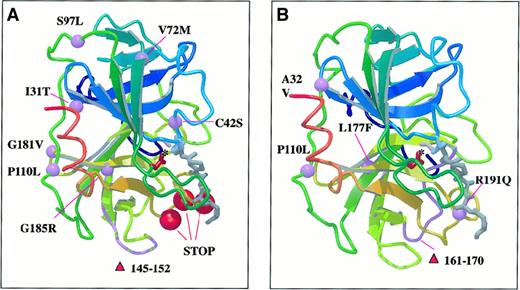 Fig. 4. Ribbon diagram of neutrophil elastase with schematic representation of beta strands in complex with a peptide methoxysuccinyl-Ala-Ala-Pro-Ala chloromethyl ketone inhibitor. / Purple balls and chain fragment represent missense and deletion mutations. Red balls represent positions of truncation mutations in congenital neutropenia (A) and cyclic neutropenia (B). See text for explanations of effects of mutations noted. Drawing by E. Adman, University of Washington, using MOLSCRIPT (P. Kraulis. Molscript: a program to produce both detailed and schematic plots of protein structure. J Appl Crystallogr. 1991;24:946-950) and Raster3D (Merritt EA, Murphy MEP. Raster3D Version 2.0 a program for photorealistic molecular graphics. Acta Cyrstallogr. 1994;D50:869-873).