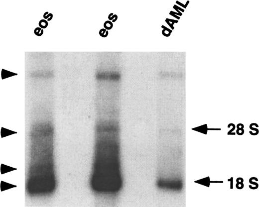 Fig. 1. Northern blot analysis of CCR3 mRNA. / Total RNA (4 μg) from the eosinophils (eos) of 2 individuals and from butyric acid/IL-5 differentiated AML14.3D10 cells (dAML) was hybridized with a radiolabeled full-length CCR3 ORF probe under high stringency conditions. Autoradiography was performed for 72 hours. The locations of 28 S and 18 S RNA are shown on the right and hybridized bands are labeled with an arrowhead.