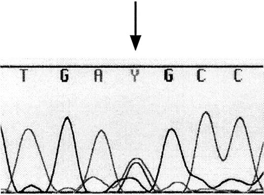 Fig. 5. Detection of the promoter polymorphism. / PCR-amplified DNA from 19 individuals was subjected to sequence analysis using dye-primer sequencing. A heterozygous polymorphism was detected in the DNA from one individual. Equal amounts of thymine and cytosine peaks indicate heterozygosity at position −37 of theCCR3 gene (as indicated by the arrow). Y indicates thymine and cytosine.