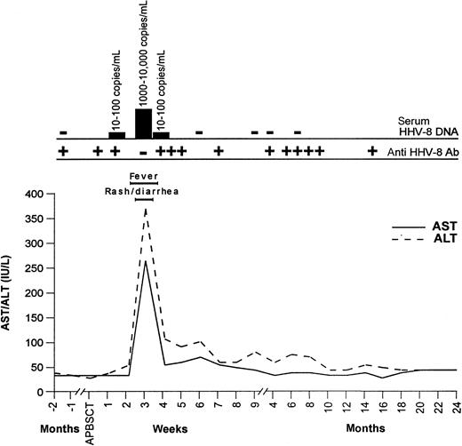 Fig. 1. Clinical history and virologic study. / Kinetics of AST and ALT, clinical signs, HHV-8 DNA (copies/mL), and anti-HHV-8 antibodies (Ab) in the patient, after autologous peripheral blood stem cell transplantation (APBSCT).