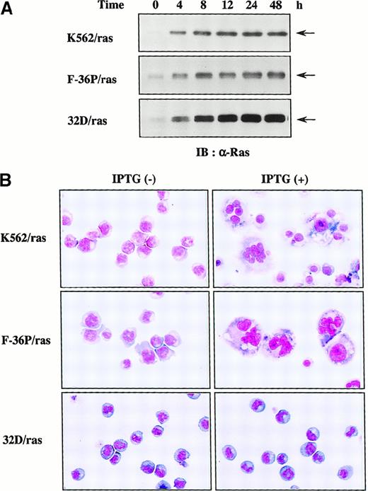 Fig. 1. Inducible expression of H-rasG12V in K562/ras, F-36P/ras, and 32D/ras. / (A) Western blot analysis on Ras expression during IPTG treatment. Each clone was treated with 0.5 mmol/L IPTG for the time indicated. Total cell lysates were subjected to SDS-PAGE and probed with anti-Ras antibody. (B) Light micrograph of K562/ras, F-36P/ras, and 32D/ras before and after 5-day culture with IPTG. Cytocentrifugation preparation from each culture was stained with May–Grünwald–Giemsa (original magnification, ×100).