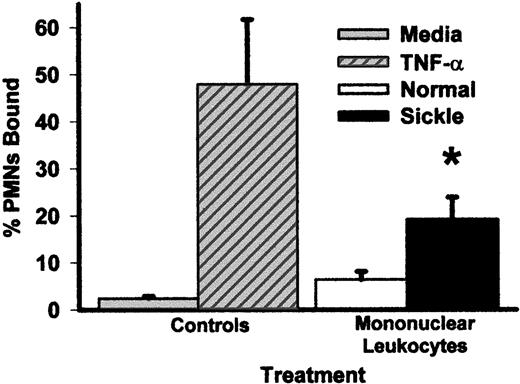 Fig. 1. Pretreatment of HUVEC with mononuclear leukocytes from patients with sickle cell disease increases the adhesion of normal PMNL to HUVEC relative to media alone or to mononuclear leukocytes from normal subjects. / HUVEC were pretreated with media alone, TNF-α (10 ng/mL), or sickle or normal mononuclear leukocytes (2 leukocytes/endothelial cell) for 4 hours at 37°C. After the 4-hour pretreatment period, the endothelial monolayer was washed 3 times, and 51Cr-labeled normal PMNL were added to HUVEC and incubated for 15 minutes. HUVEC were washed 3 times, and PMNL adhesion to endothelium was calculated by counting radioactivity in the cell bound and unbound wash fractions. Results are expressed as percentage of PMNL bound to HUVEC. *P < .05 for sickle versus normal mononuclear leukocytes.