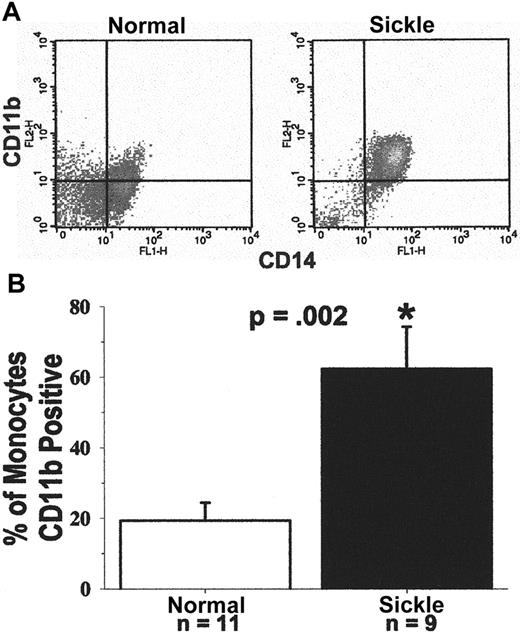 Fig. 9. (A) Typical flow cytometry analysis of CD11b and CD14 expression on the surfaces of monocytes from a patient with sickle cell disease and a normal subject. / Leukocytes were obtained from blood after the lysis of RBCs. They were immunostained for the surface expression of CD11b and CD14. Immunostained monocytes were analyzed by flow cytometry. A gate was placed around the mononuclear leukocytes based on their forward and side scatter. Monocytes within that gate were identified based on their expression of CD14-specific immunofluorescence. The crosshatch separates specific and nonspecific immunofluorescence. Cells to the right of the crosshatch are CD14+ monocytes, and cells above the crosshatch are CD11b+ monocytes. Monocytes in the upper right quadrant are activated, and monocytes in the lower right quadrant are resting. In this example, based on CD11b surface expression, 97% of the patient's monocytes are activated and 3% are resting; 37% of the normal subject's monocytes are activated and 63% are resting. (B) Sickle monocytes are activated: summary of CD11b flow cytometry results. Expression of CD11b and CD14 on monocytes was measured by flow cytometry in 9 patients and 11 normal subjects, as described in A. Results are presented as the percentage of CD14+ monocytes that are CD11b+. On average, 62% of sickle monocytes were activated as judged by CD11b surface expression compared to only 19% of normal monocytes (P = .002). Six of the 9 patients were admitted to the hospital for pain crisis. Surface expression of monocyte CD11b in the crisis (P = .029) and noncrisis patient groups (P = .007) was statistically greater than normal.