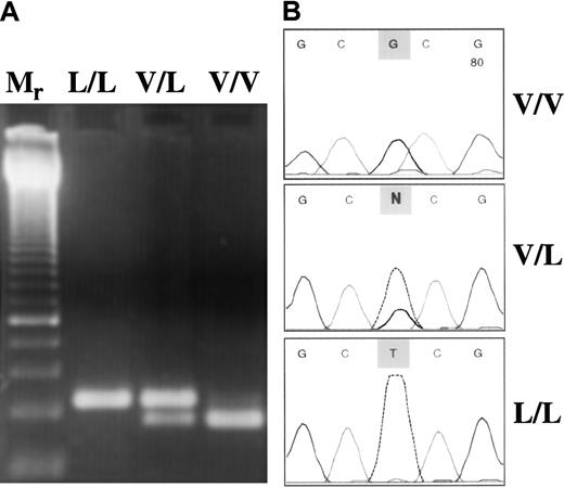Fig. 1. Molecular genetic analysis of FXIII Val34Leu polymorphism. / (A) Restriction digestion pattern of PCR products. Mr, 50-bp ladder with a double-intensity band of 250 bp. Because the homozygous mutant (L/L) genotype has no restriction site forCfoI, only the nondigested 114-bp PCR product could be seen. In the V/L heterozygous sample, both the intact product (114 bp) and the 94-bp fragment were present. In the wild-type (V/V) sample, the 94-bp single band demonstrates complete digestion. (B) Evaluation of the PCR–restriction digestion method based on amplification created a restriction site by fluorescent DNA sequencing. Representative electropherograms corresponding to the respective genotype are shown.