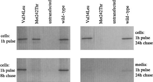 Fig. 2. Investigation of the intracellular stability of wild-type and Val34Leu mutant recombinant FXIII-A by pulse chase analysis. / Metabolic labeling of COS cells transfected with wild-type or mutant FXIII-A was performed by incubating the cells with35S-methionine. The presence of labeled FXIII antigen was analyzed after variable chase periods (shown are the 8-hour and 24-hour periods) by immunoprecipitating the cell lysates with FXIII A-subunit antibody and subjecting the precipitated proteins to 10% SDS-PAGE. Radiolabeled FXIII-A was visualized by autoradiography. Met242Thr represents a mutation associated with instability of the protein and FXIII deficiency.