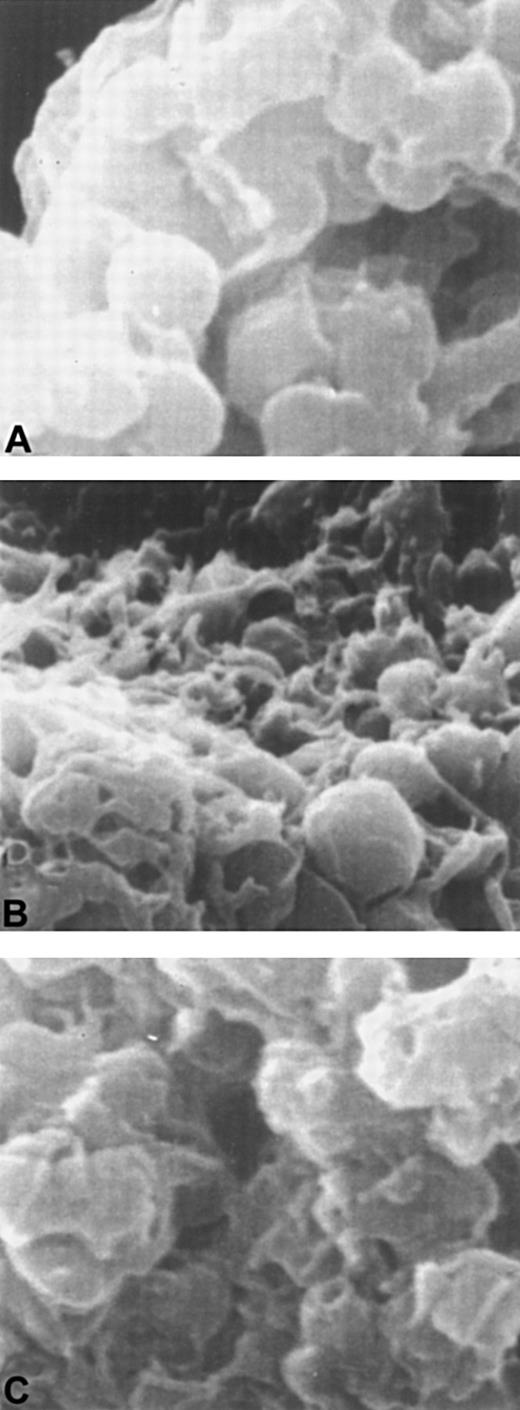 Fig. 8. Scanning electron microscopy of platelets treated with D3 or ADP or both D3 and ADP. / Panel A shows platelets treated with D3. Platelets incubated with ADP are shown in panel B, and platelets with D3 and ADP are shown in panel C.