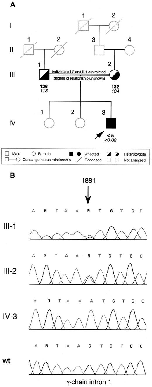 Fig. 1. Family pedigree of the afibrinogenemic proband and electropherograms showing the identified splice site mutation. / (A) Pedigree of the Pakistani family. Plasma functional fibrinogen levels (mg/dL) and immunoreactive fibrinogen levels (mg/dL) are indicated in this order below each symbol. The arrow indicates the proband. (B) Electropherograms showing the mutation identified in the afibrinogenemic Pakistani proband. The G→A transition, whose nucleotide position is indicated by an arrow (numbering according to GenBank accession number M10014), was present at the heterozygous state in both parents and absent in a healthy control individual (wt). Family members are labeled as in (A); R, A or G nucleotide.