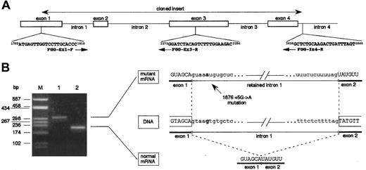 Fig. 3. Functional analysis of the effect of splice-donor site mutation 1876 + 5G→A on γ-chain mRNA. / (A) Schematic representation of the 5′ portion of the fibrinogen γ-chain gene. Primers used in cloning experiments (FGG-Ex1-F and FGG-In4-R) and in RT-PCR assays (FGG-Ex1-F and FGG-Ex3-R) are reported. Numbers preceding and following each oligonucleotide indicate primer position (numbering according to GenBank accession number M10014); arrows indicate primer orientation. (B) Left panel: RT-PCR products obtained with primers FGG-Ex1-F and FGG-Ex3-R, separated on a 2% agarose gel. Lane M: molecular weight marker (pUC8-HaeIII); lane 1: RT-PCR product amplified from transfected HeLa cells expressing mutant mRNA; lane 2: RT-PCR product amplified from transfected HeLa cells expressing wild-type mRNA. Right panel: schematic representation of the normal and aberrant splicing events. Nucleotide at position +5 of intron 1 is in bold-face type in both wild-type and mutant sequences.