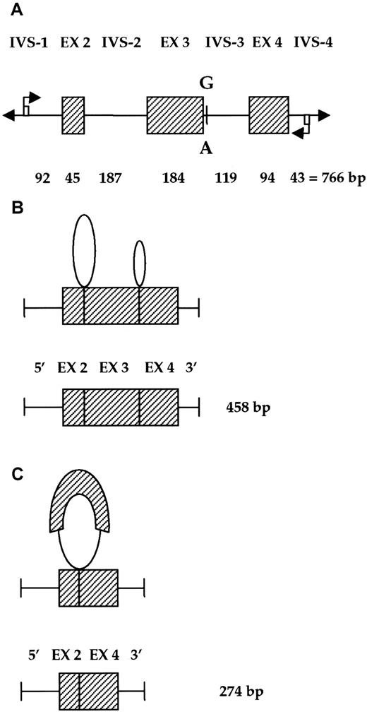 Fig. 3. Experimental design. / (A) Schematic representation of the construct transfected in human kidney HEK 293 cells. The position of primers is reported. (B) Predicted splicing (top) and mRNA product (bottom) in cells transfected with the normal construct. (C) Predicted splicing (top) and mRNA product (bottom) in cells transfected with the construct containing the A2395 mutation. Dashed boxes refer to exons. Closed loops indicate spliced RNA sequences.