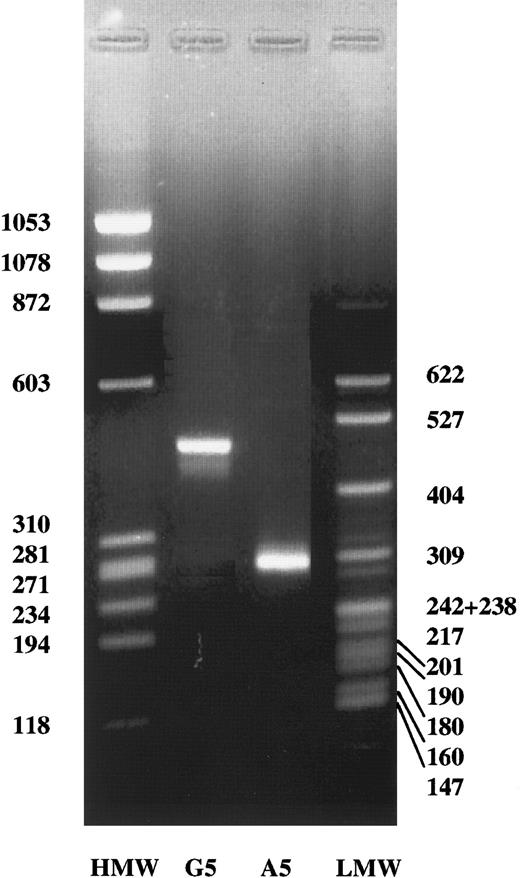 Fig. 4. Detection of mRNA splicing products. / In vitro splicing of HEK 293 cells transfected with the normal construct (G2395) or with the construct containing the mutation (A2395). HMW, ΦX174 HaeIII digest DNA molecular weight markers. LMW, pBR322 MspI digest DNA molecular weight markers. The molecular weights are indicated.