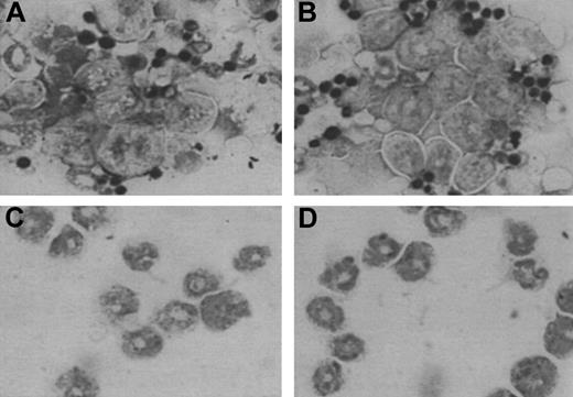Fig. 1. Morphologic and cytochemical features of fetal liver–derived cells in culture with IL-5 (5 ng/mL). / Cytospin preparations of fetal liver–derived cells from wild-type (A,C) and Syk−/− (B,D) mice, maintained for 2 (A,B) and 12 (C,D) days after EPO staining and counterstaining. EPO is present in both mature and immature forms of eosinophils even when eosinophilic granules are not prominent. EPO+ cells at day 2 display the morphologic characteristics of precursors (large cell size and large unsegmented nucleus with loose chromatin), whereas EPO+cells at day 12 display characteristics of mature eosinophils (smaller cell size, donut-shaped nucleus with compact chromatin). Original magnification × 100.